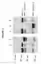 Fig. 05 - Control of RAGE fusion protein glycosylation and RAGE fusion protein compositions