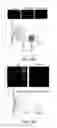 Fig. 33 - EPIGENETIC MECHANISMS RE-ESTABLISH ACCESS TO LONG-TERM MEMORY AFTER NEURONAL LOSS