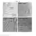 Fig. 06 - CD93 or use of soluble fragment thereof