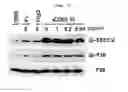 Fig. 08 - CD93 or use of soluble fragment thereof