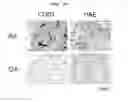 Fig. 25 - CD93 or use of soluble fragment thereof