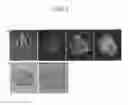 Fig. 02 - Composition for enhancing immunity containing plant stem cell line derived from cambium of including wild ginseng or ginseng as an active ingredient