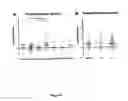 Fig. 07 - Tuberculosis TB vaccine to prevent reactivation
