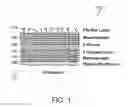 Fig. 02 - Therapy for lysosomal enzyme deficiencies