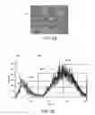 Fig. 06 - Therapy for lysosomal enzyme deficiencies
