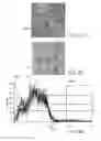 Fig. 07 - Therapy for lysosomal enzyme deficiencies