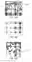 Fig. 10 - Therapy for lysosomal enzyme deficiencies