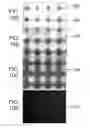 Fig. 16 - Therapy for lysosomal enzyme deficiencies