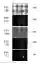 Fig. 19 - Therapy for lysosomal enzyme deficiencies