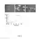 Fig. 03 - Outer membrane vesicles and uses thereof