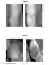 Fig. 09 - Colostrum composition