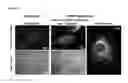 Fig. 12 - Liposome compositions and methods of use thereof