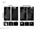 Fig. 16 - Liposome compositions and methods of use thereof