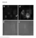 Fig. 23 - Liposome compositions and methods of use thereof