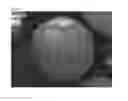 Fig. 02 - DISINTEGRATING PARTICLE COMPOSITION AND RAPIDLY DISINTEGRATING COMPRESSION-MOLDED MATERIAL USED THE SAME