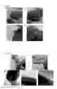 Fig. 09 - PRECURSOR POWDER FOR SINTERING USED FOR PREPARING DIELECTRIC MATERIAL AND PROCESS FOR PREPARING THE SAME