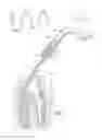 Fig. 02 - Endodontic procedure employing simultaneous liquefaction and acoustic debridement