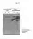 Fig. 167 - METHOD OF DETECTING PROGRESSION OF A NEURODEMENTING DISEASE