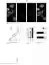 Fig. 07 - MOLECULES ABLE TO MODULATE THE EXPRESSION OF AT LEAST A GENE INVOLVED IN DEGRADATIVE PATHWAYS AND USES THEREOF