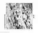 Fig. 26 - FABRICATION OF NANOFIBER REINFORCED STRUCTURES FOR TISSUE ENGINEERING