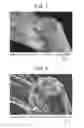 Fig. 02 - NANOFIBERS, NANOFILMS AND METHODS OF MAKING/USING THEREOF