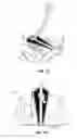 Fig. 07 - Golf club head with alignment markings