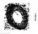 Fig. 04 - Method of treating dyspnea associated with acute heart failure