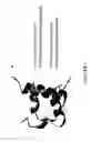 Fig. 02 - Method of treating dyspnea associated with acute heart failure by administering H2 relaxin