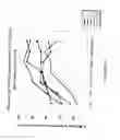 Fig. 08 - Method of treating dyspnea associated with acute heart failure by administering H2 relaxin