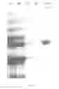 Fig. 06 - MEANS FOR PURIFYING A COAGULATION PROTEIN, AND METHODS FOR IMPLEMENTING SAME