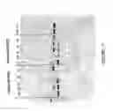 Fig. 18 - Antisense oligonucleotides for inducing exon skipping and methods of use thereof