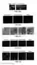 Fig. 09 - NOVEL AUTOGRAPHY REGULATORS ATG14L AND RUBICON