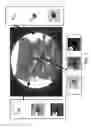 Fig. 04 - Target tracking device and radiation therapy apparatus