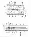 Fig. 04 - Method and apparatus for long-term assisting a left ventricle to pump blood