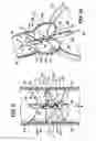 Fig. 07 - Method and apparatus for long-term assisting a left ventricle to pump blood