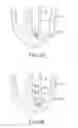 Fig. 04 - Apparatus and methods for supporting cardiac ischemic tissue