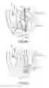 Fig. 15 - Apparatus and methods for supporting cardiac ischemic tissue