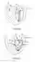 Fig. 16 - Apparatus and methods for supporting cardiac ischemic tissue