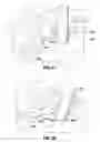 Fig. 13 - IMPLANTABLE ACCESS PORT SYSTEM
