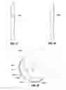 Fig. 15 - IMPLANTABLE ACCESS PORT SYSTEM