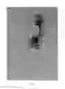 Fig. 07 - TWO-PART ENDOSCOPE SURGICAL DEVICE