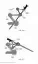Fig. 16 - TWO-PART ENDOSCOPE SURGICAL DEVICE