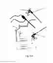 Fig. 26 - TWO-PART ENDOSCOPE SURGICAL DEVICE