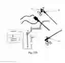 Fig. 27 - TWO-PART ENDOSCOPE SURGICAL DEVICE