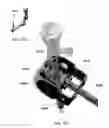 Fig. 51 - TWO-PART ENDOSCOPE SURGICAL DEVICE