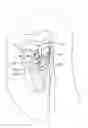 Fig. 01 - Expandable thoracic access port