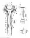 Fig. 03 - Surgical access apparatus