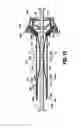 Fig. 07 - Surgical access apparatus
