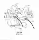 Fig. 03 - Surgical instrument system and method for providing retraction and vertebral distraction