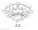 Fig. 04 - Surgical instrument system and method for providing retraction and vertebral distraction